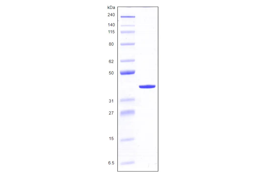 [MC03-025] Recombinant Human Galectin 8, variant 1, His Tag (317 a.a.) -25 ug